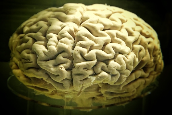 brainfood voeding voor je brein